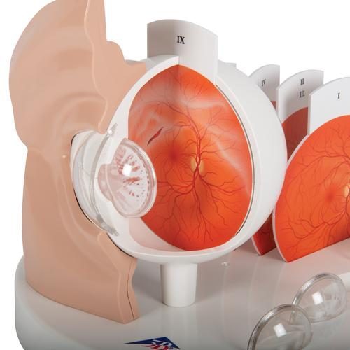 F17_05_Pathological-Human-Eye-Model-3B-Smart-Anatomy.jpg