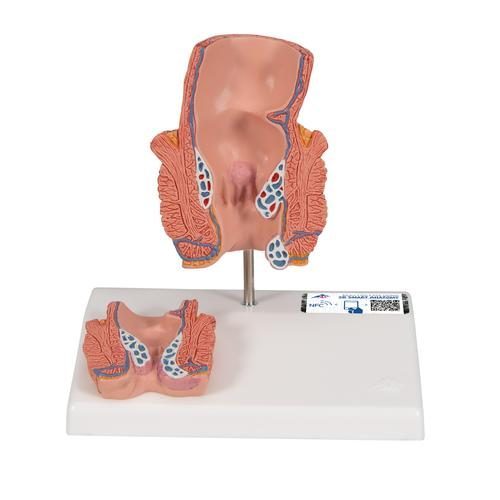 K27_01_Hemorrhoid-Model-3B-Smart-Anatomy.jpg