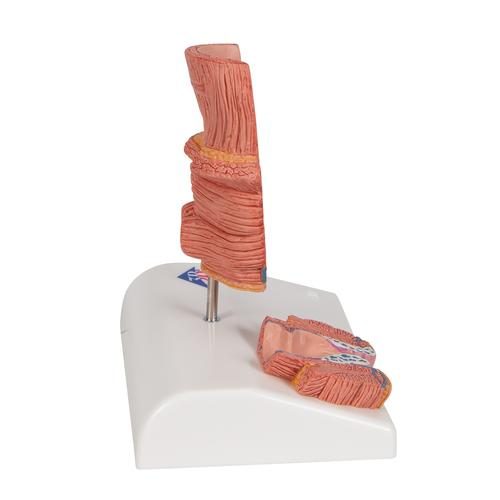 K27_03_Hemorrhoid-Model-3B-Smart-Anatomy.jpg