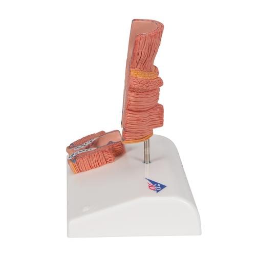 K27_05_Hemorrhoid-Model-3B-Smart-Anatomy.jpg